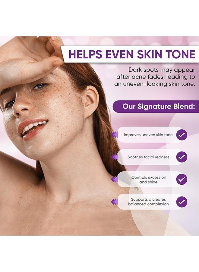 CARVENCHY 14% Azelaic Acid - for Face, Redness-Soothing Azelaic Acid Facial Cream for Uneven Tone, Blemish-Prone Skin, Pore Care and Skin Clarity Support - Image 4